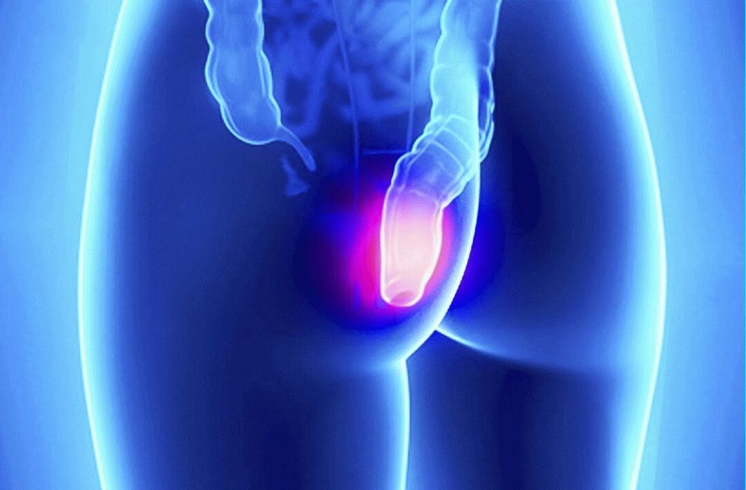 Gelarex può essere utilizzato sia esternamente che rettalmente